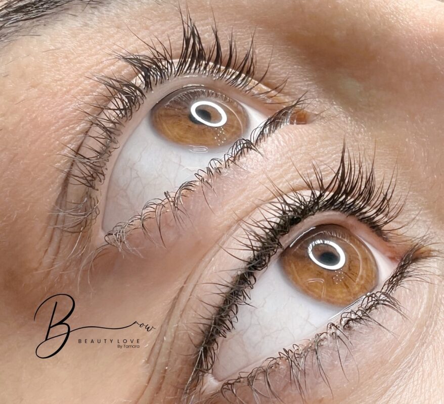 eyes