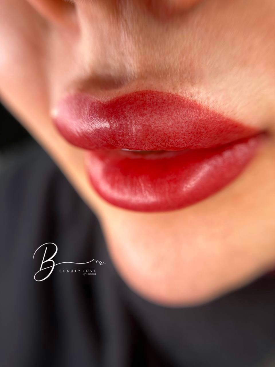 Lips